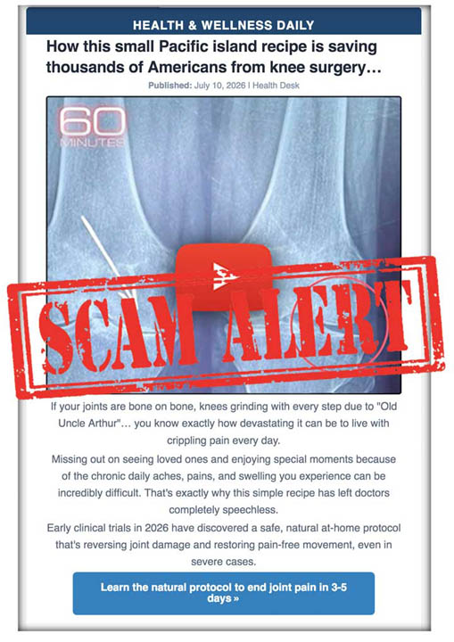 2607-11_Knee_Surgery