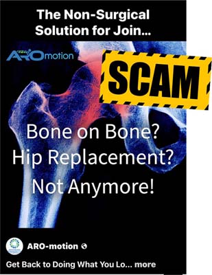 2608-17_bones